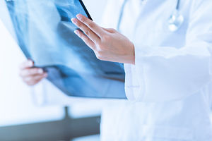 Female Radiologist looking at an X-RAY